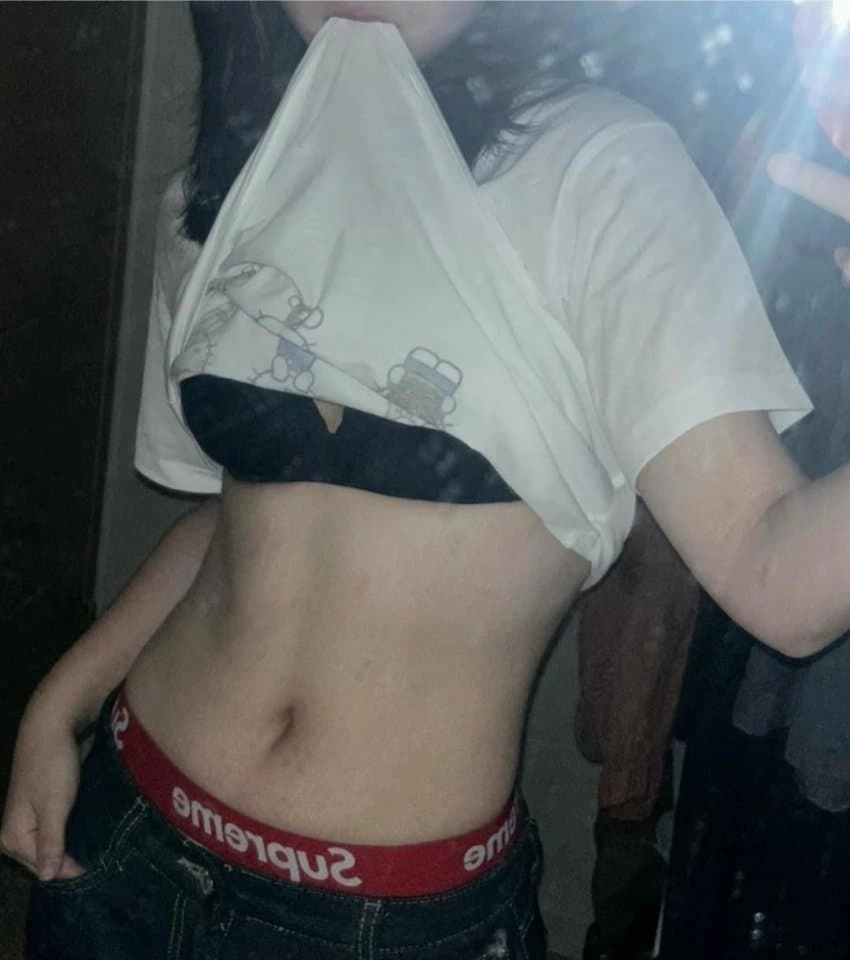 이런배꼽은 무슨모양이라 봐야하지